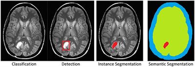 Active Learning Performance in Labeling Radiology Images Is 90% Effective